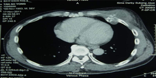 Orthopaedics Oncology