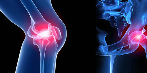 Arthroscopic Surgery