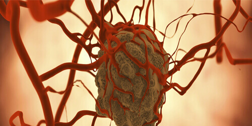 Medical Oncology