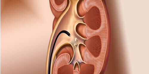 Genitourinary Surgery