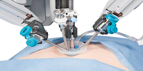 Robotic Surgery