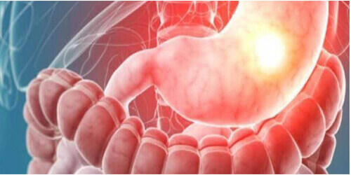 Surgical Gastroenterology