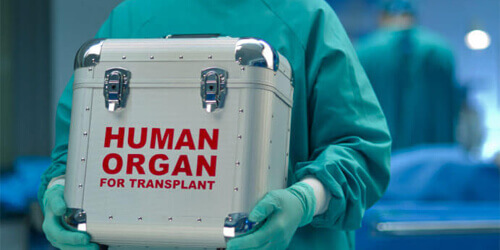 Organ Transplantation