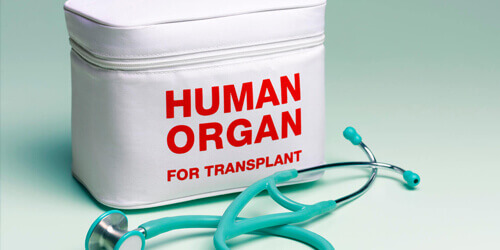 Transplant