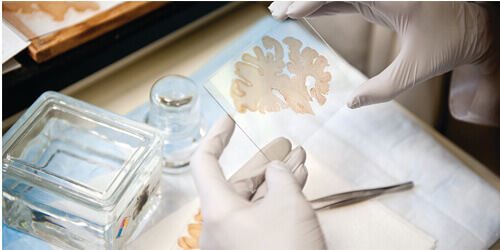 Neuropatholgy