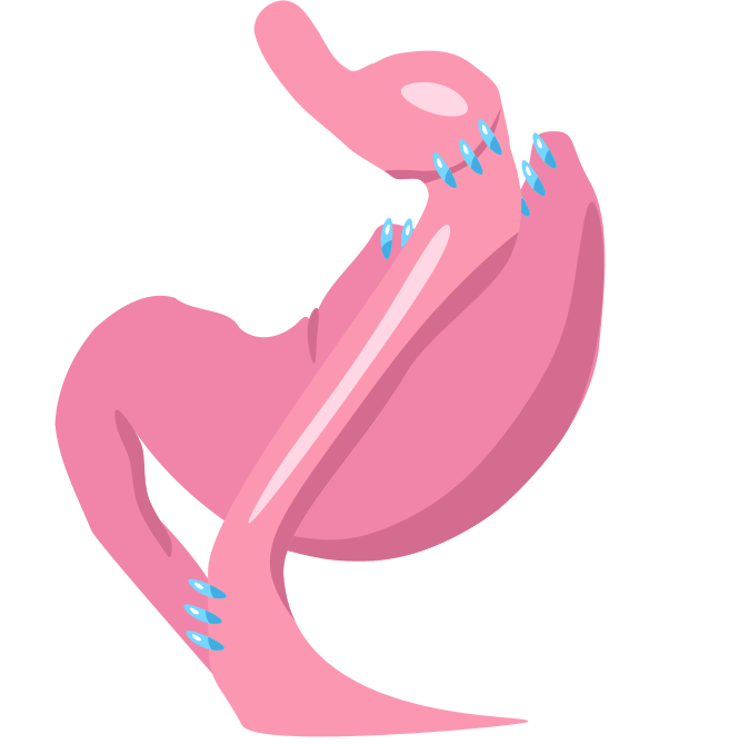 Gastric Bypass Surgery