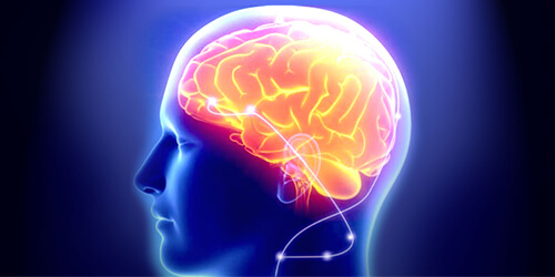 Deep Brain Stimulation